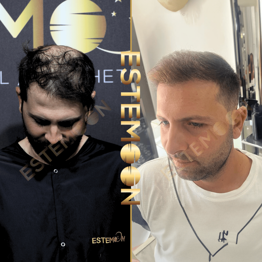 ıc beforeafter (6) (1)