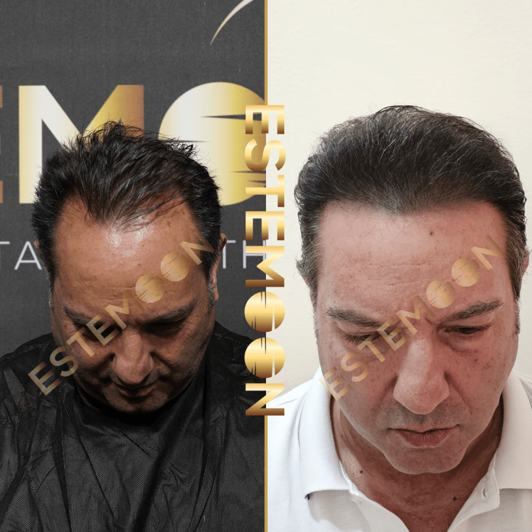 ıc beforeafter (6)